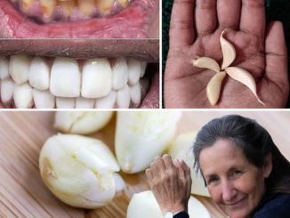 Why Garlic is most important for teeth whitening