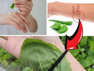 Heal damaged skin quickly and don’t leave scars from boiling water burns thanks to this leaf