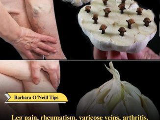 Leg pain, rheumatism, varicose veins, arthritis, headache, joint pain. Mother’s natural remedy