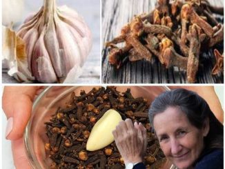 How to prepare recipe – My mom couldn’t WALK because of varicose veins and pain in her legs – Only polite members say thank you