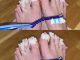 If you have nail fungus try this natural remedy: it disappears quickly