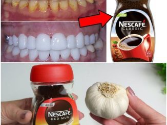 Natural Teeth Whitening at Home: A Surprising Solution with Garlic and Coffee