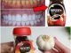 Natural Teeth Whitening at Home: A Surprising Solution with Garlic and Coffee