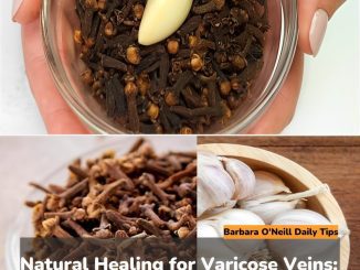 Natural Healing for Varicose Veins: Garlic and Cloves